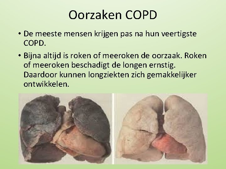 Oorzaken COPD • De meeste mensen krijgen pas na hun veertigste COPD. • Bijna