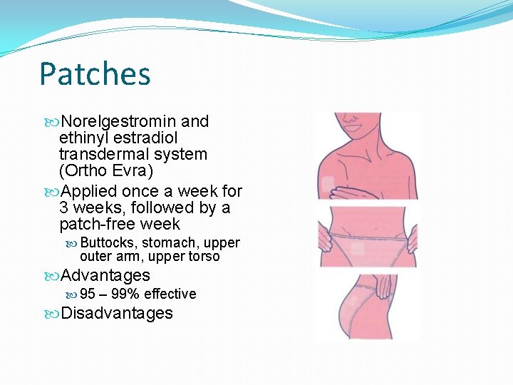Patches Norelgestromin and ethinyl estradiol transdermal system (Ortho Evra) Applied once a week for