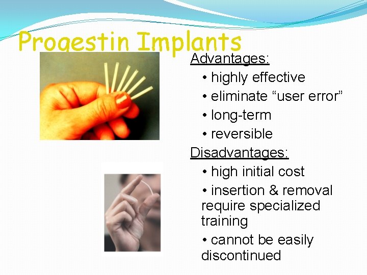 Progestin Implants Advantages: • highly effective • eliminate “user error” • long-term • reversible