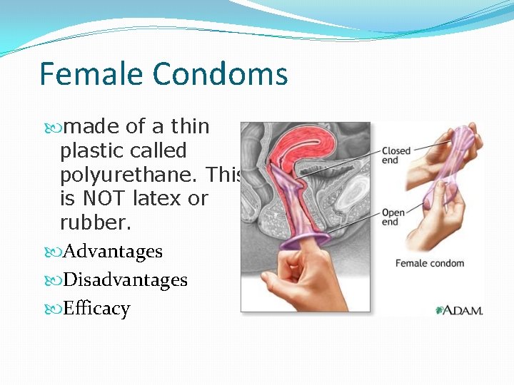 Female Condoms made of a thin plastic called polyurethane. This is NOT latex or