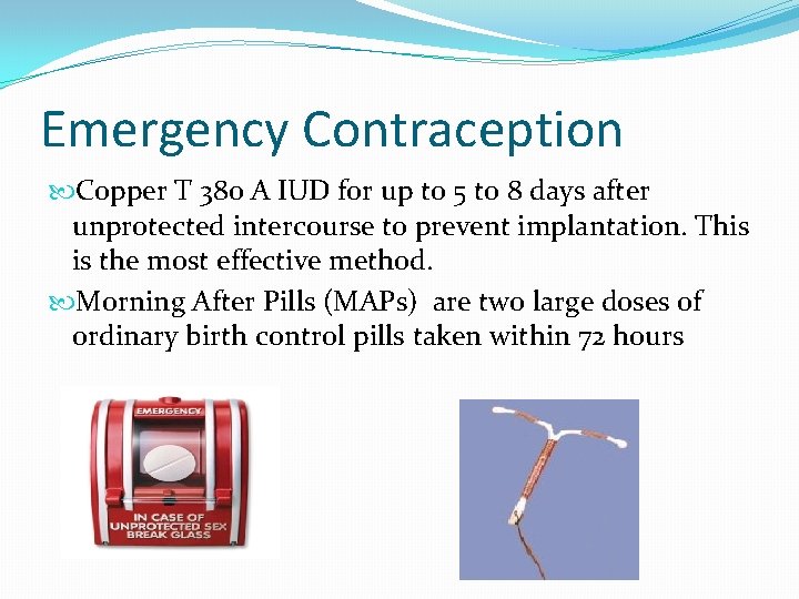 Emergency Contraception Copper T 380 A IUD for up to 5 to 8 days