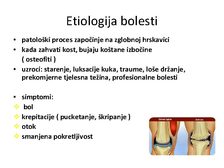 Etiologija bolesti • patološki proces započinje na zglobnoj hrskavici • kada zahvati kost, bujaju Etiologija bolesti • patološki proces započinje na zglobnoj hrskavici • kada zahvati kost, bujaju