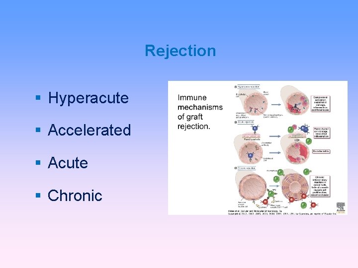 Rejection Hyperacute Accelerated Acute Chronic 
