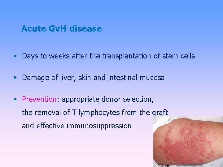 Acute Gv. H disease Days to weeks after the transplantation of stem cells Damage