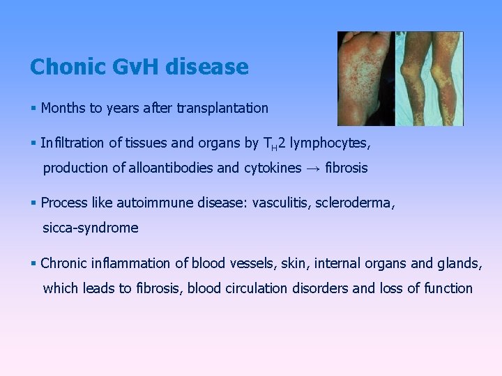 Chonic Gv. H disease Months to years after transplantation Infiltration of tissues and organs