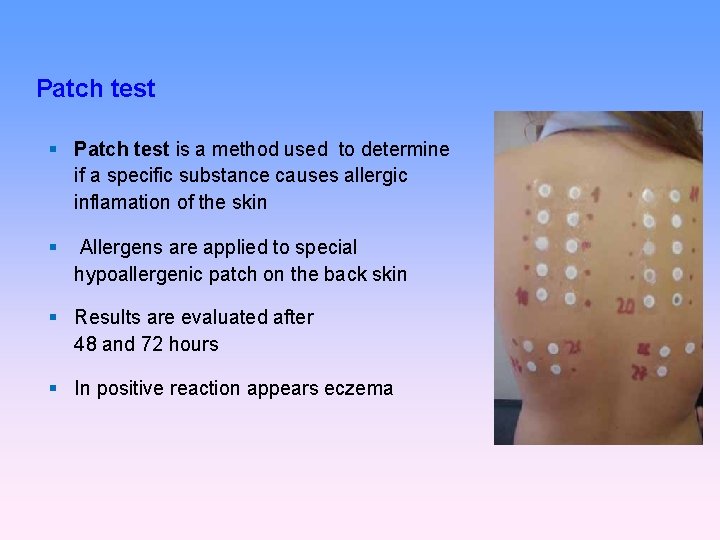 Patch test is a method used to determine if a specific substance causes allergic