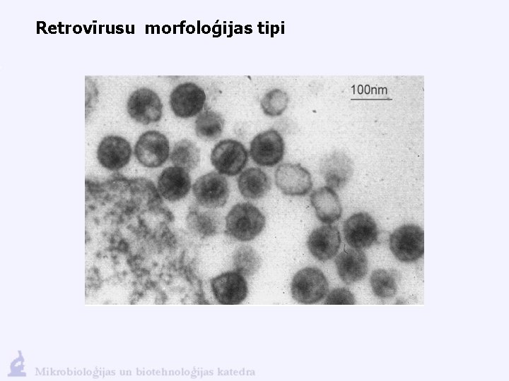 Retrovīrusu morfoloģijas tipi 