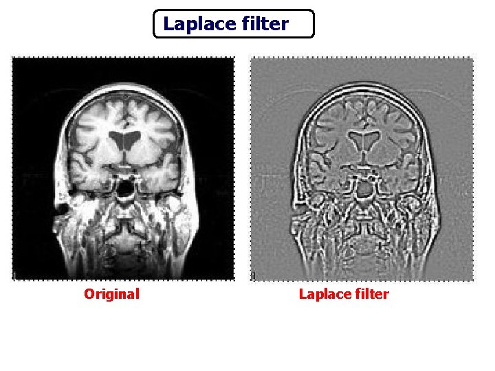 Laplace filter Original Laplace filter 