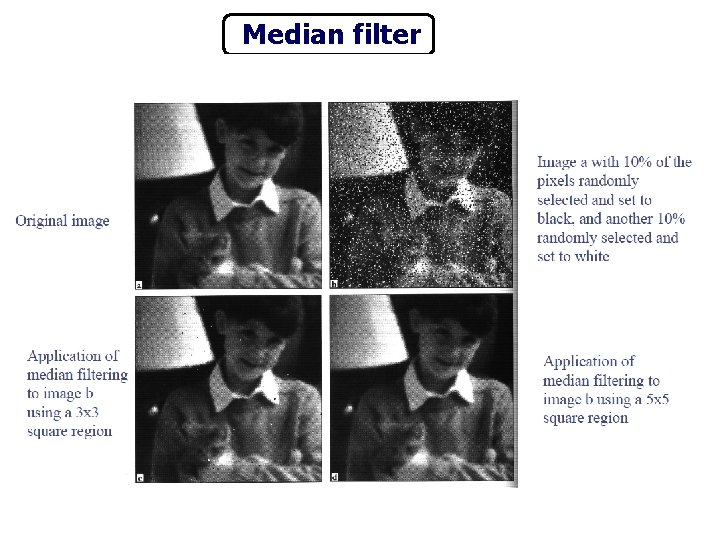 Median filter 