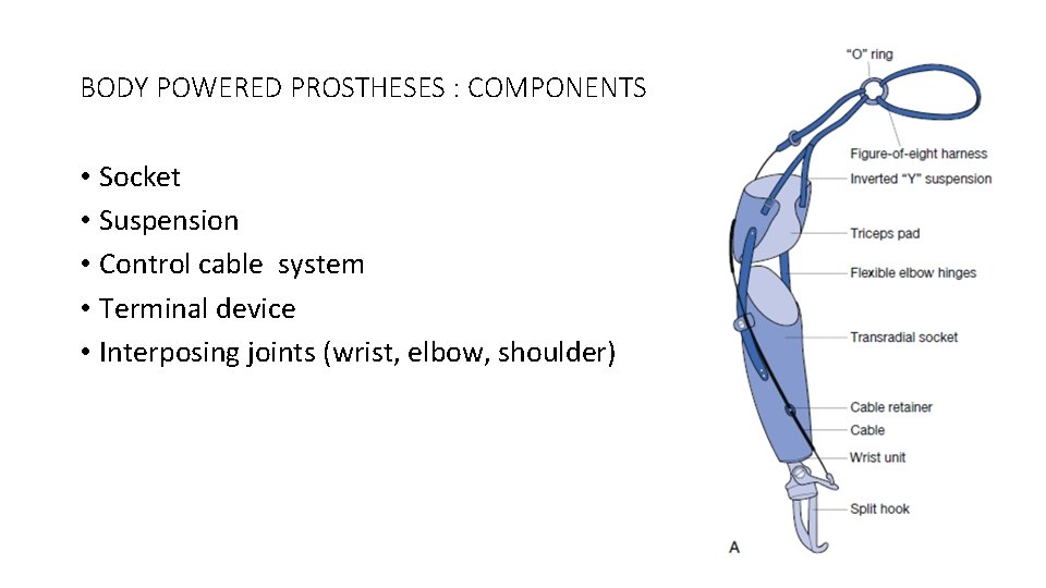 BODY POWERED PROSTHESES : COMPONENTS • Socket • Suspension • Control cable system •