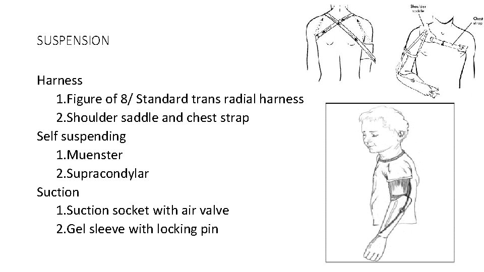 SUSPENSION Harness 1. Figure of 8/ Standard trans radial harness 2. Shoulder saddle and