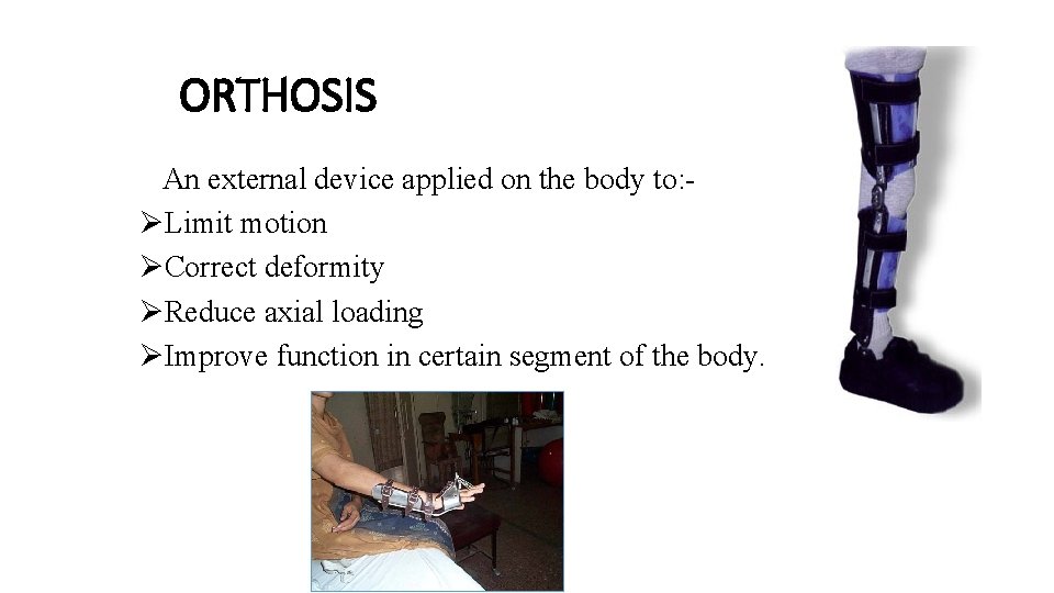 ORTHOSIS An external device applied on the body to: ØLimit motion ØCorrect deformity ØReduce