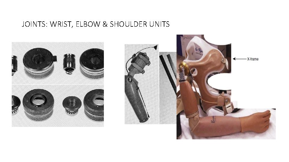 JOINTS: WRIST, ELBOW & SHOULDER UNITS 