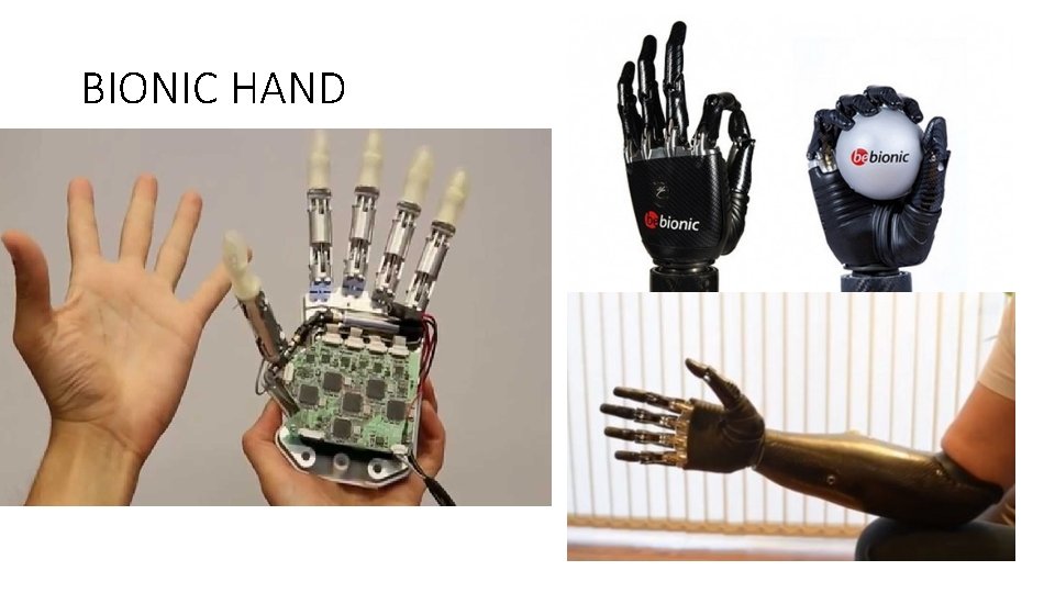 BIONIC HAND 