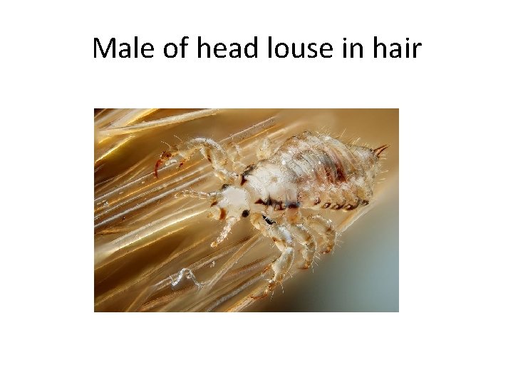 Male of head louse in hair 