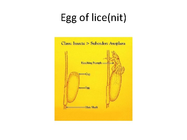 Egg of lice(nit) 
