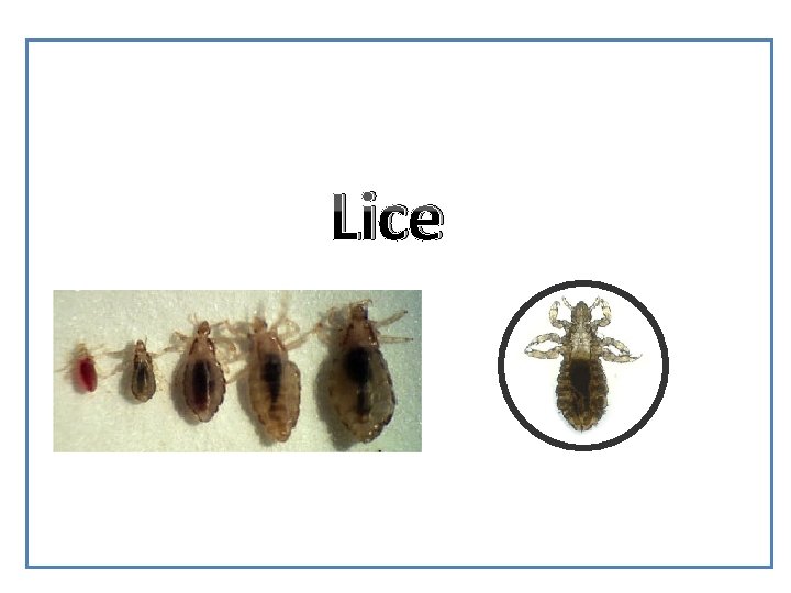 Lice 