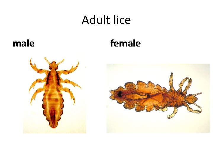 Adult lice male female 