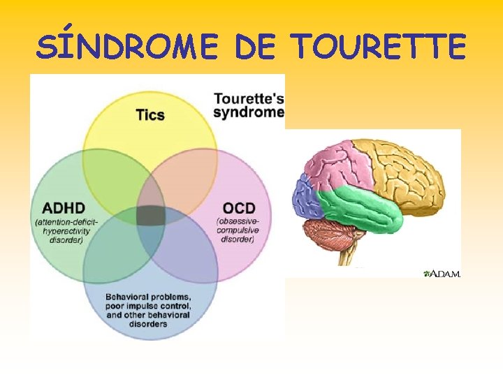 SÍNDROME DE TOURETTE 