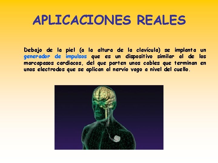 APLICACIONES REALES Debajo de la piel (a la altura de la clavícula) se implanta