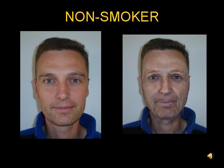 NON-SMOKER 