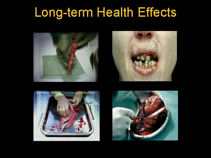 Long-term Health Effects 