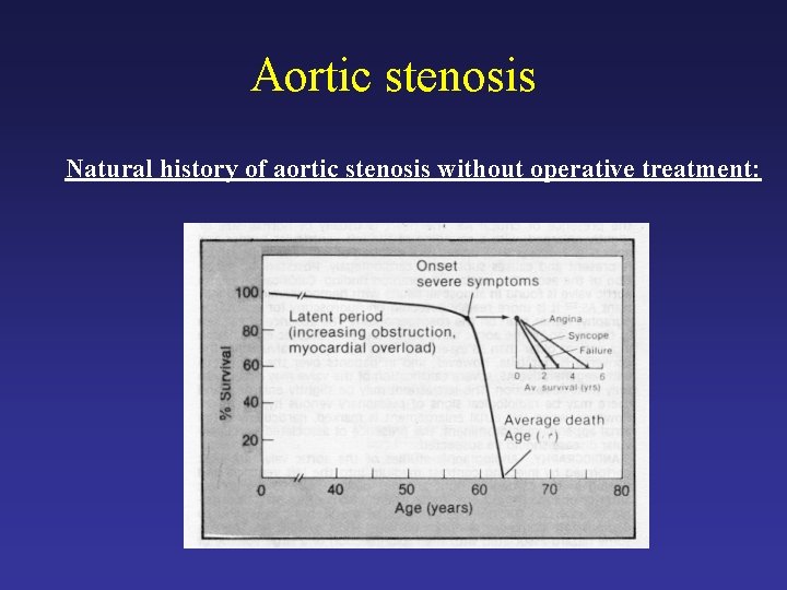 Aortic stenosis Natural history of aortic stenosis without operative treatment: 