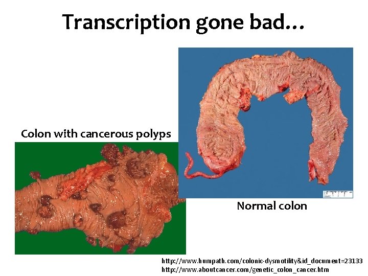 Transcription gone bad… Colon with cancerous polyps Normal colon http: //www. humpath. com/colonic-dysmotility&id_document=23133 http: