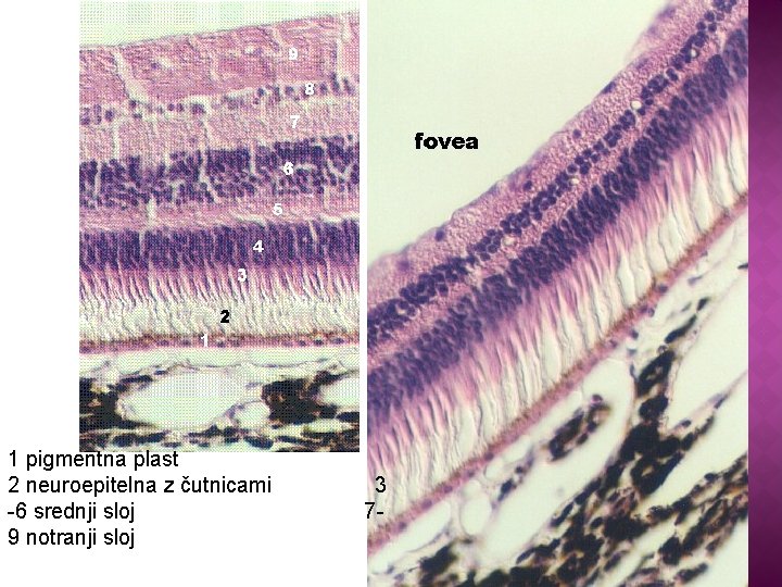 1 pigmentna plast 2 neuroepitelna z čutnicami -6 srednji sloj 9 notranji sloj 3