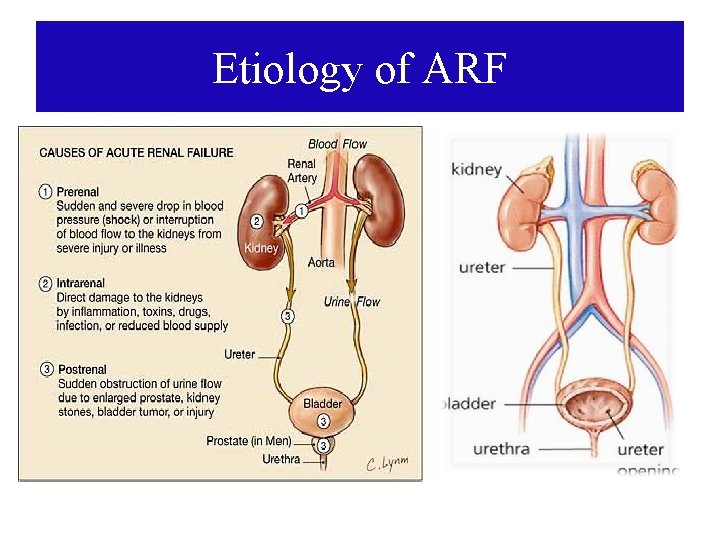 Etiology of ARF 