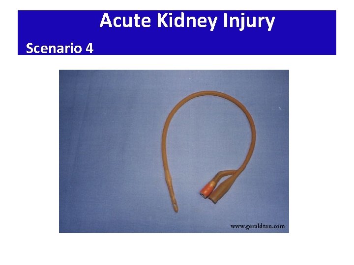 Acute Kidney Injury Scenario 4 