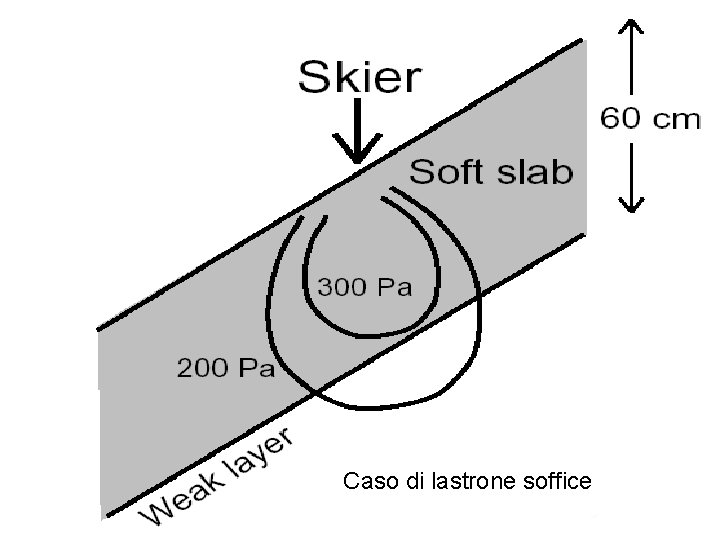 Caso di lastrone soffice 