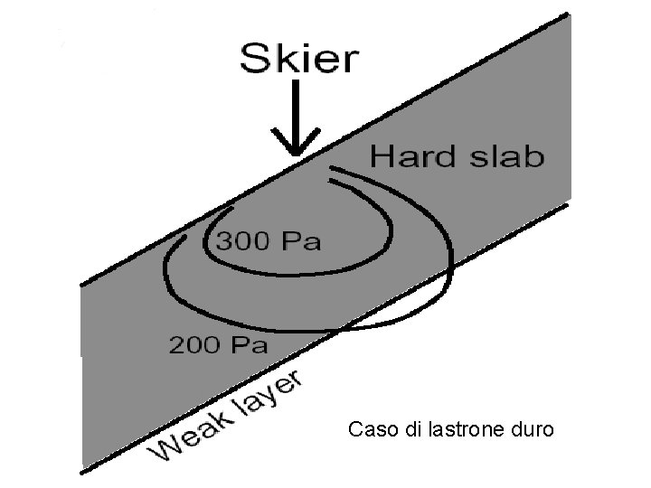 Caso di lastrone duro 