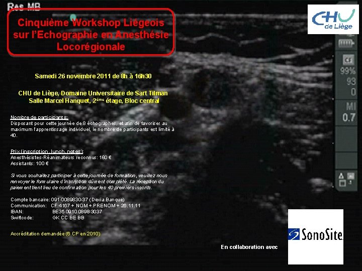 Cinquième Workshop Liégeois sur l’Echographie en Anesthésie Locorégionale Samedi 26 novembre 2011 de 8