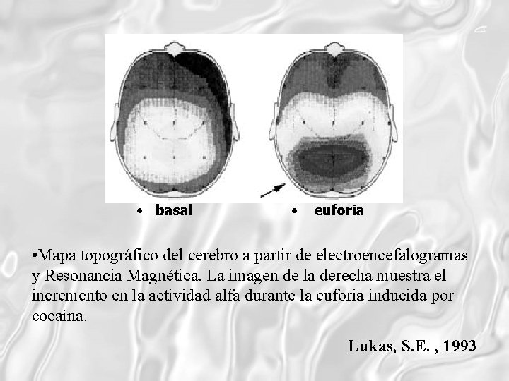  • basal • euforia • Mapa topográfico del cerebro a partir de electroencefalogramas