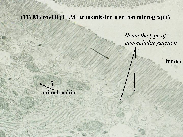 (11) Microvilli (TEM--transmission electron micrograph) Name the type of intercellular junction lumen mitochondria Bio