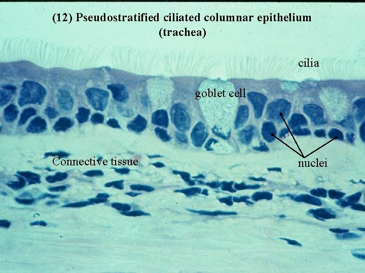 (12) Pseudostratified ciliated columnar epithelium (trachea) cilia goblet cell Connective tissue nuclei Bio 348