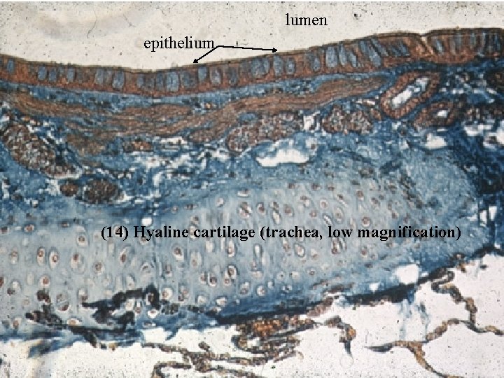 lumen epithelium (14) Hyaline cartilage (trachea, low magnification) Bio 348 Lapsansky - 2007 