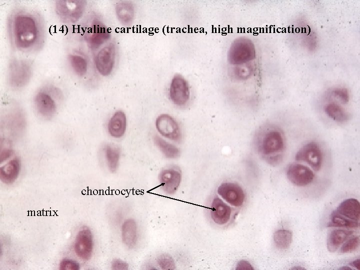 (14) Hyaline cartilage (trachea, high magnification) chondrocytes matrix Bio 348 Lapsansky - 2007 