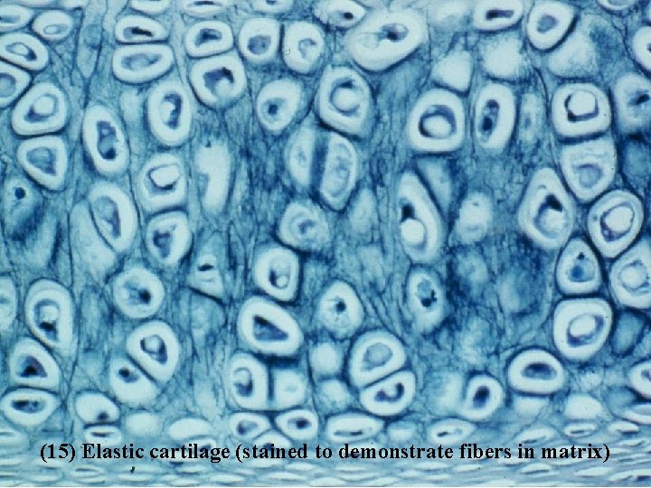 (15) Elastic cartilage (stained to demonstrate fibers in matrix) Bio 348 Lapsansky - 2007