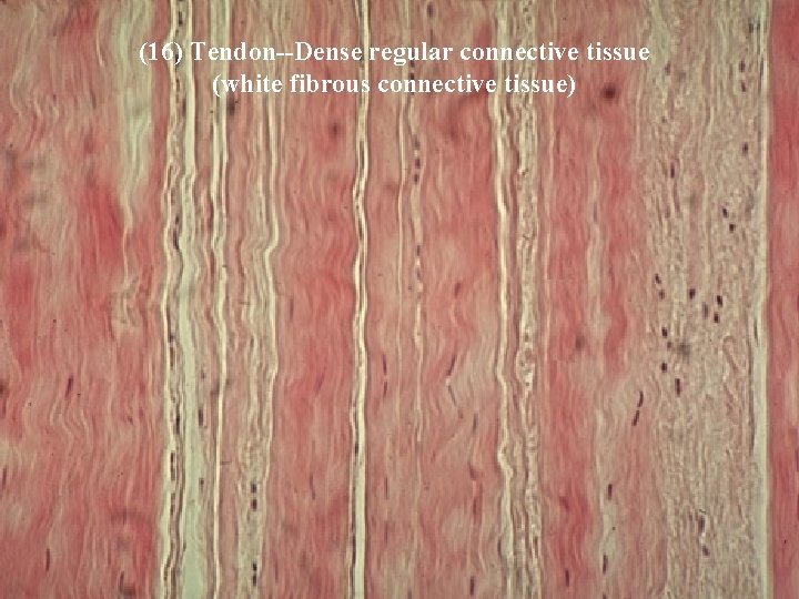 (16) Tendon--Dense regular connective tissue (white fibrous connective tissue) Bio 348 Lapsansky - 2007