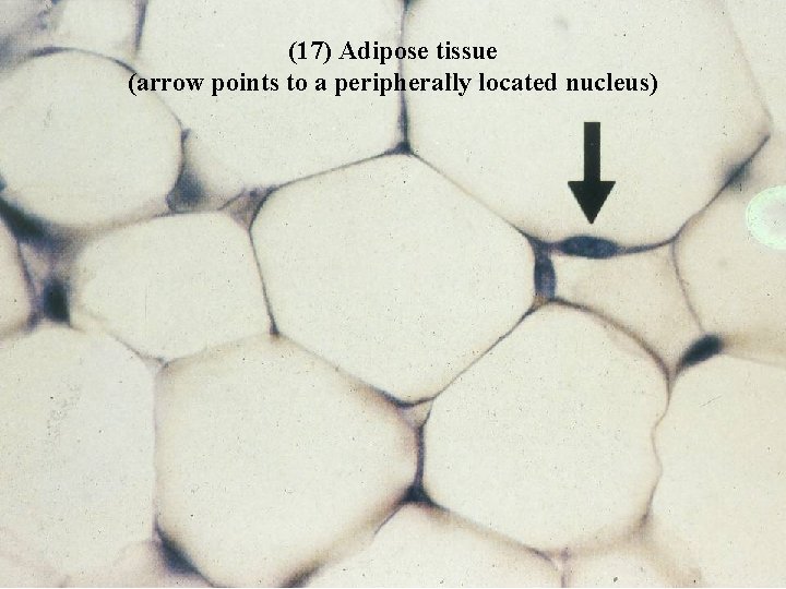 (17) Adipose tissue (arrow points to a peripherally located nucleus) Bio 348 Lapsansky -
