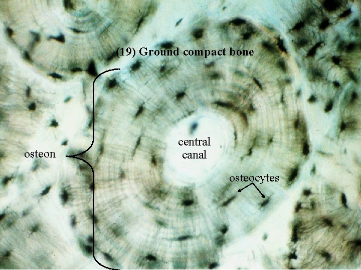 (19) Ground compact bone osteon central canal osteocytes Bio 348 Lapsansky - 2007 