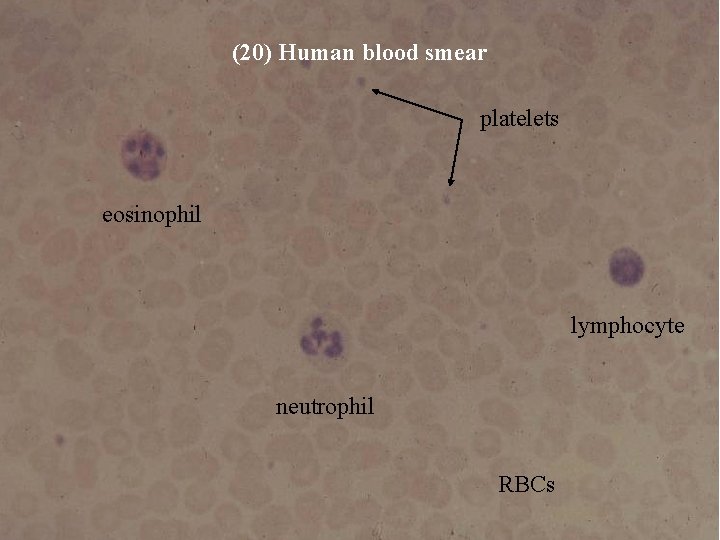 (20) Human blood smear platelets eosinophil lymphocyte neutrophil Bio 348 Lapsansky - 2007 RBCs