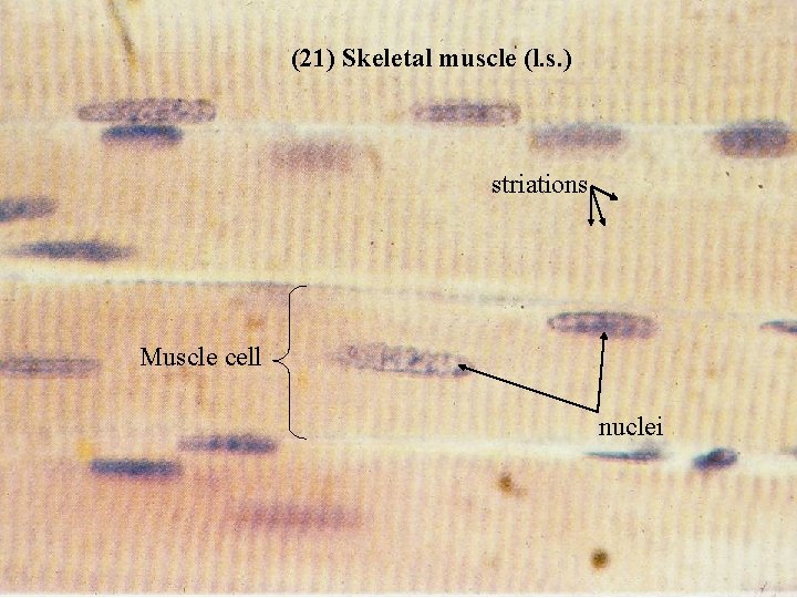 (21) Skeletal muscle (l. s. ) striations Muscle cell nuclei Bio 348 Lapsansky -