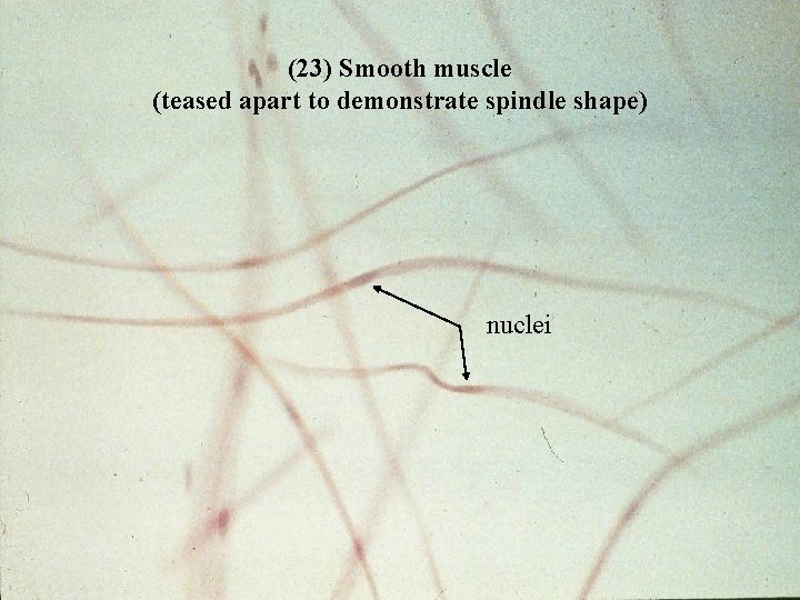 (23) Smooth muscle (teased apart to demonstrate spindle shape) nuclei Bio 348 Lapsansky -