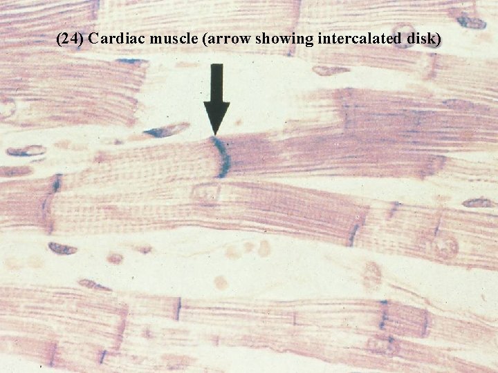 (24) Cardiac muscle (arrow showing intercalated disk) Bio 348 Lapsansky - 2007 