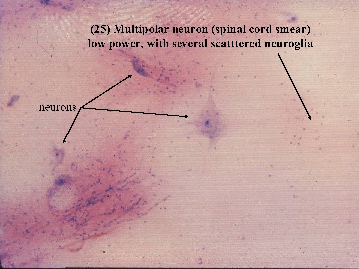 (25) Multipolar neuron (spinal cord smear) low power, with several scatttered neuroglia neurons Bio