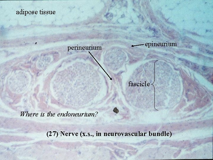 adipose tissue epineurium perineurium fascicle Where is the endoneurium? (27) Nerve (x. s. ,
