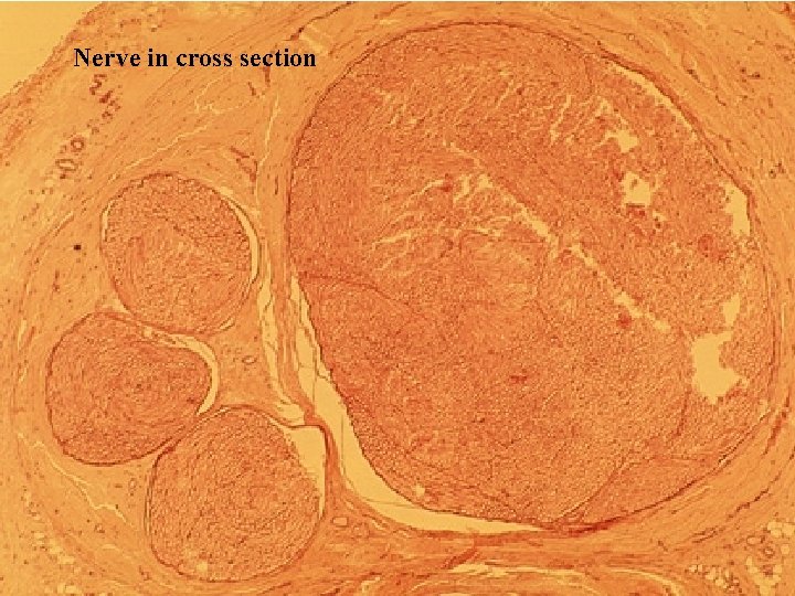 Nerve in cross section Bio 348 Lapsansky - 2007 